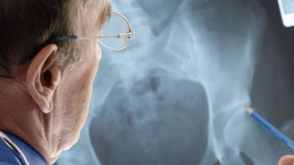 جراحی مفصل ران