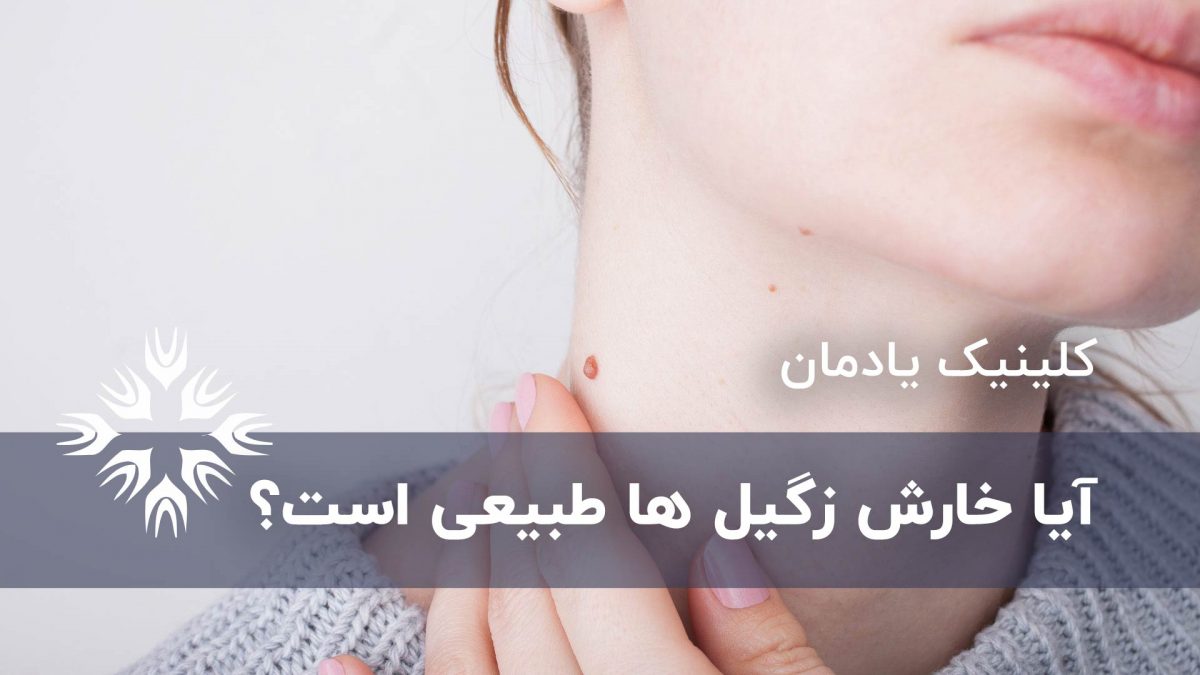 آیا خارش زگیل ها طبیعی است؟