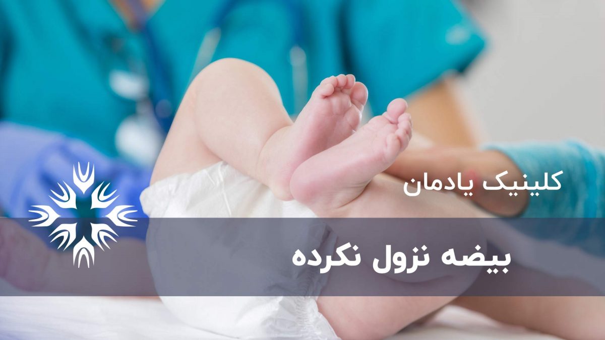 بیضه نزول نکرده