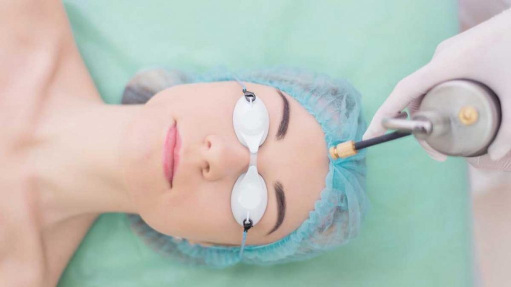 انجماد یا کرایوتراپی زگیل