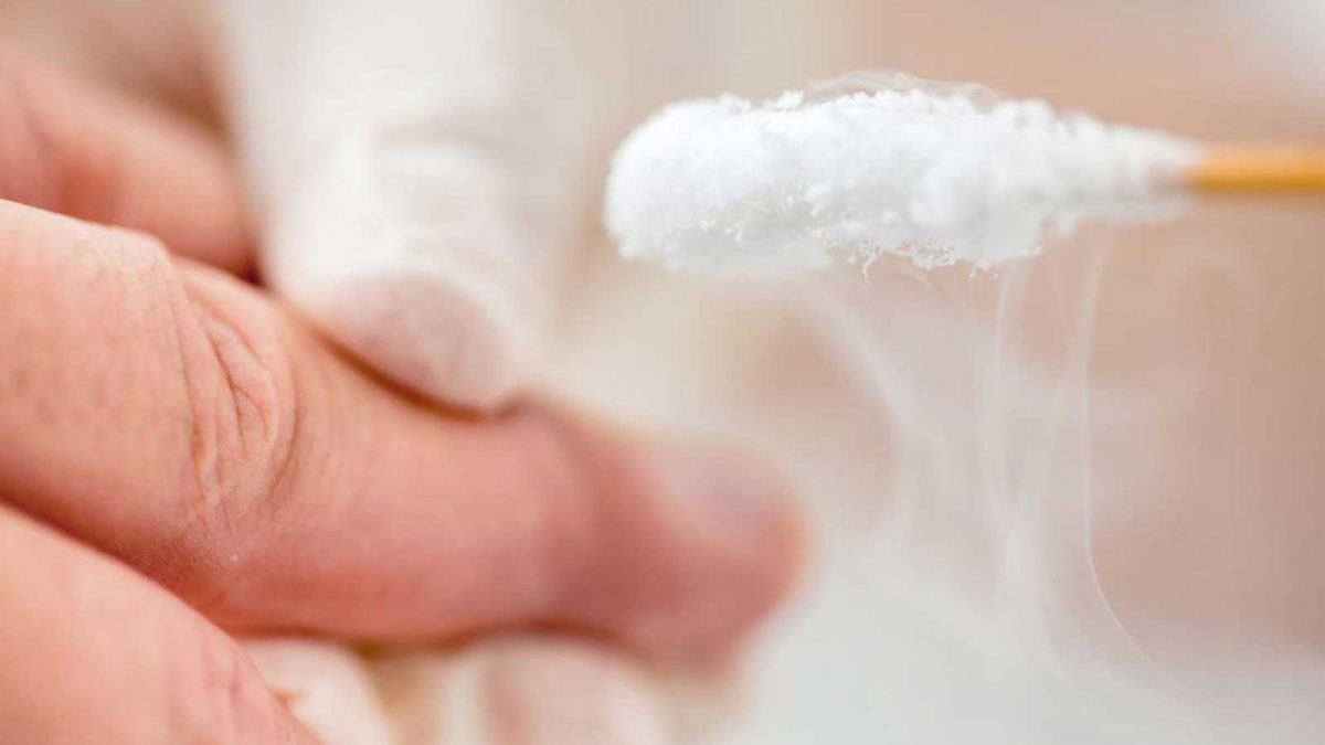 حقایقی درباره زگیل ها : راهنمای تصویری