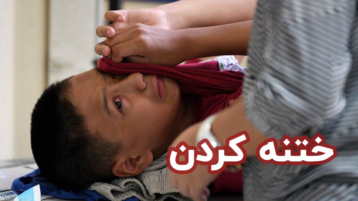 ختنه آلت تناسلی