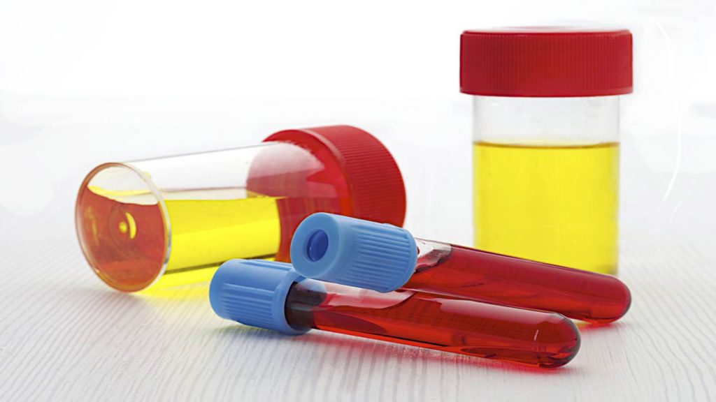 خون در ادرار