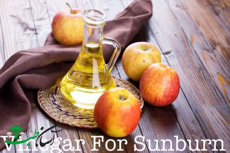 درمان آفتاب سوختگی در طب سنتی