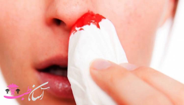 درمان خون دماغ در طب سنتی درمان خون دماغ در طب سنتی