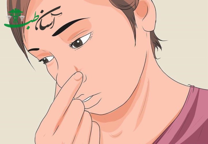 درمان خون دماغ