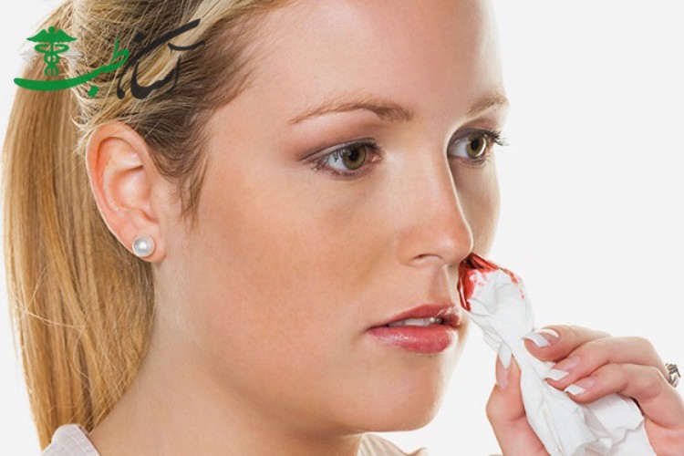 درمان خون دماغ