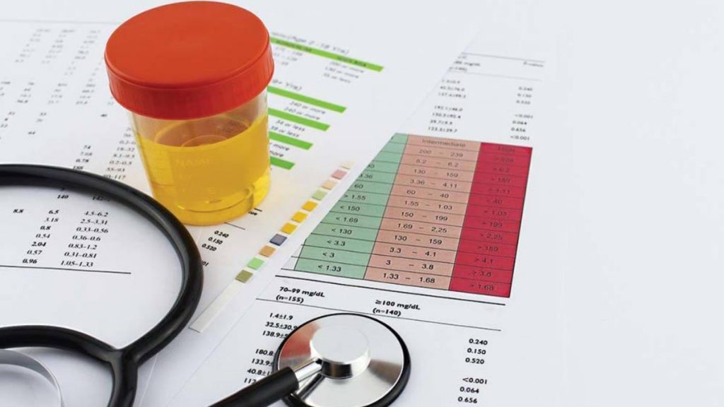 آزمایش ادرار برای تشخیص عفونت کلیه