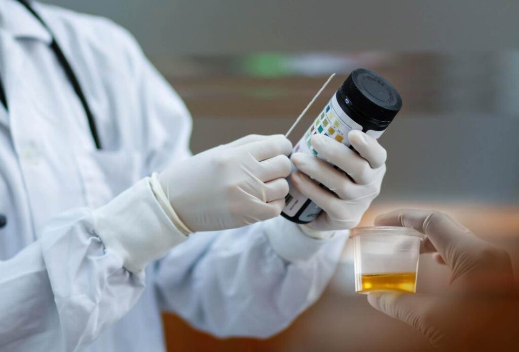 درمان ادرار کف آلود