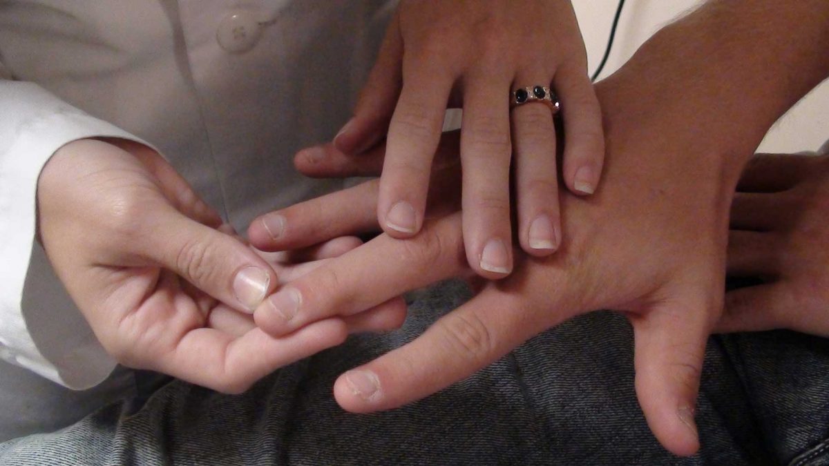 زگیل های پریونگال چه هستند؟