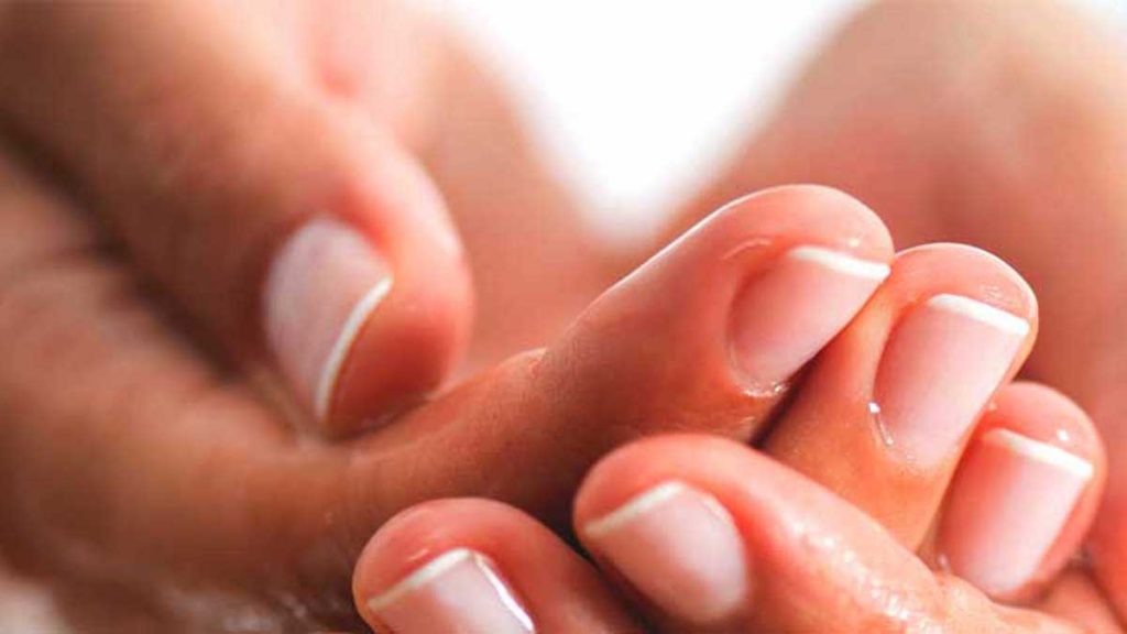 زگیل پریونگال