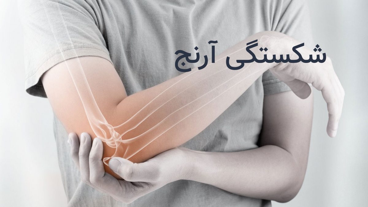 شکستگی آرنج و درمان ارتوپدی شکستگی آرنج