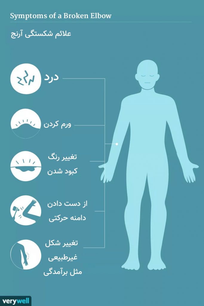 اینفوگرافیک علائم شکستگی آرنج