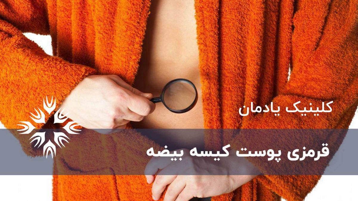 قرمزی پوست کیسه بیضه