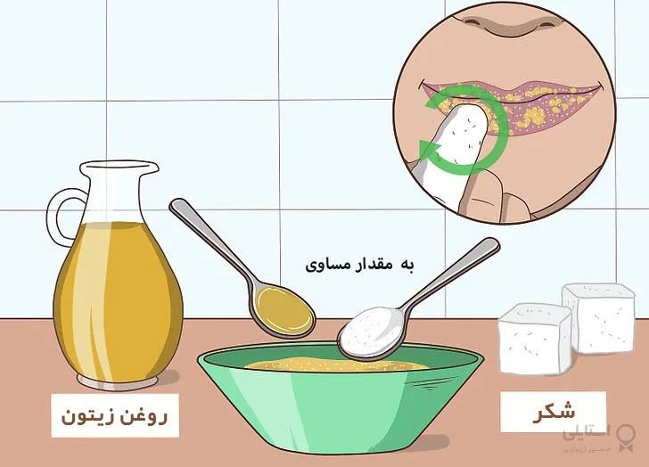 لایه برداری لب