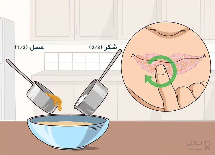 لایه برداری لب