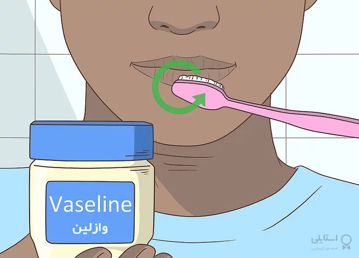 لایه برداری لب