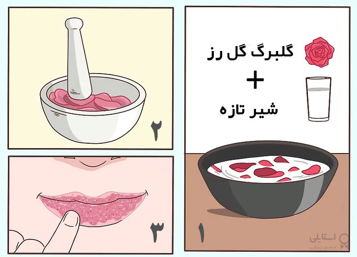 لایه برداری لب