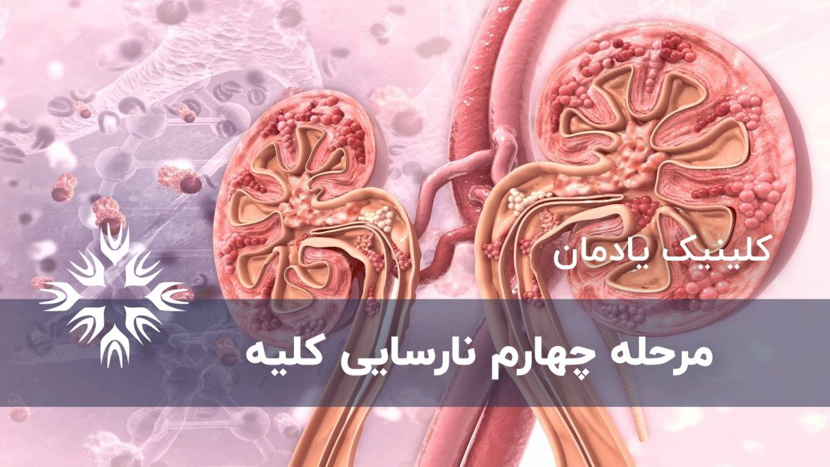 مرحله چهارم نارسایی کلیه