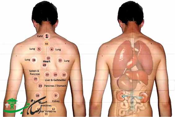بادکش درمانی