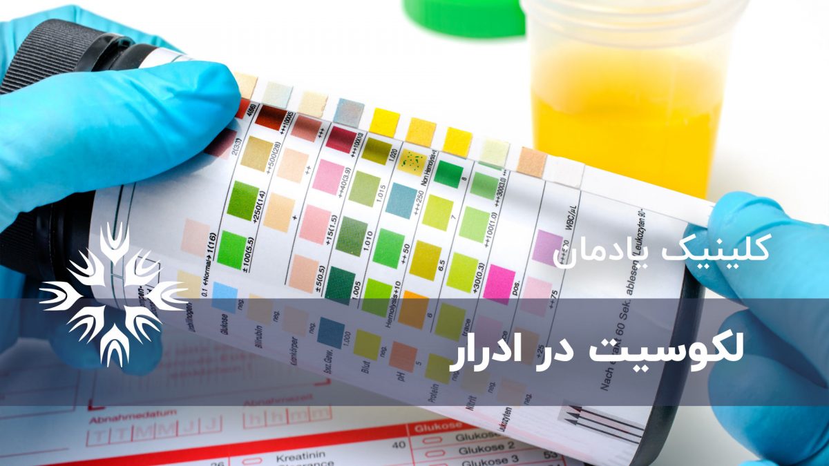 هرآنچه لازم است درباره لکوسیت در ادرار بدانید