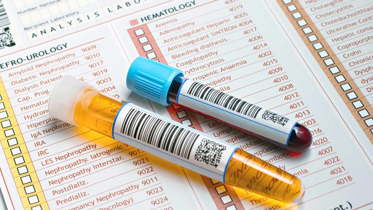 هماچوری یا خون در ادرار چیست؟