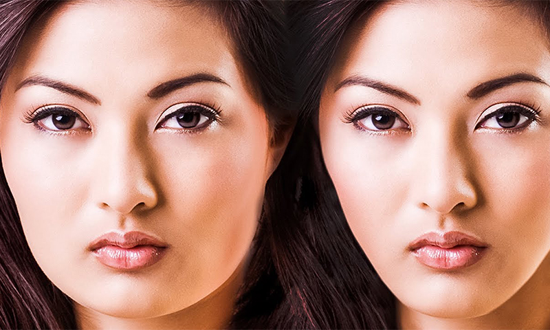 چاقی صورت و ورزش قلبی