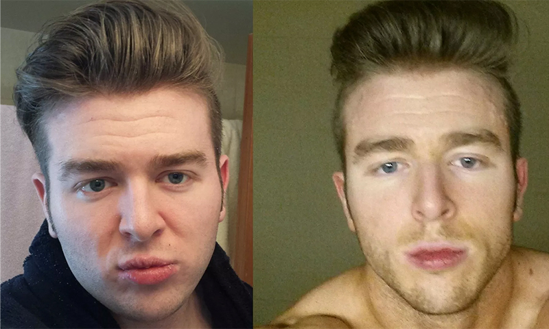 چاقی صورت و مصرف الکل