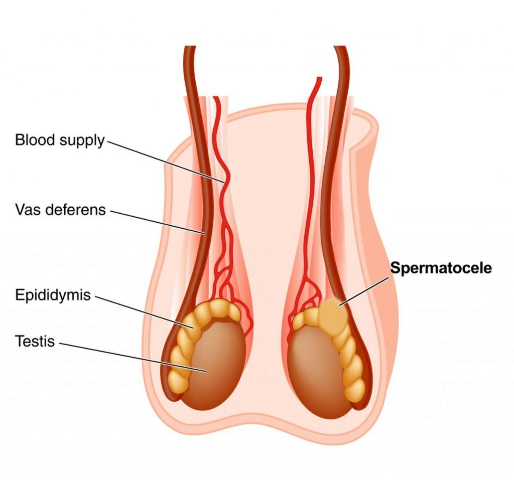 استرماتوسل