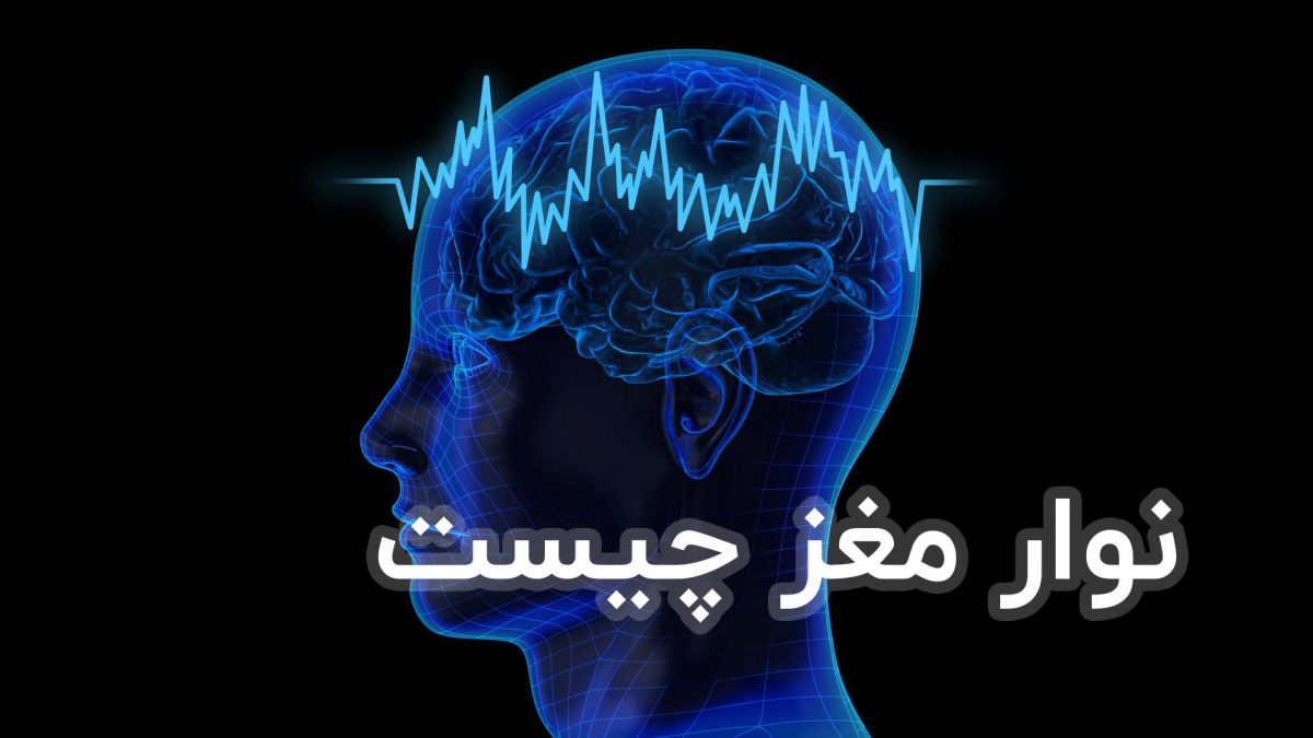 #1 نوار مغز چیست؟