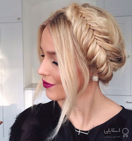 گیس تیغ ماهی روی فرق سر