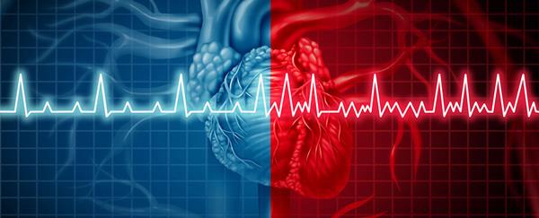 آریتمی قلبی