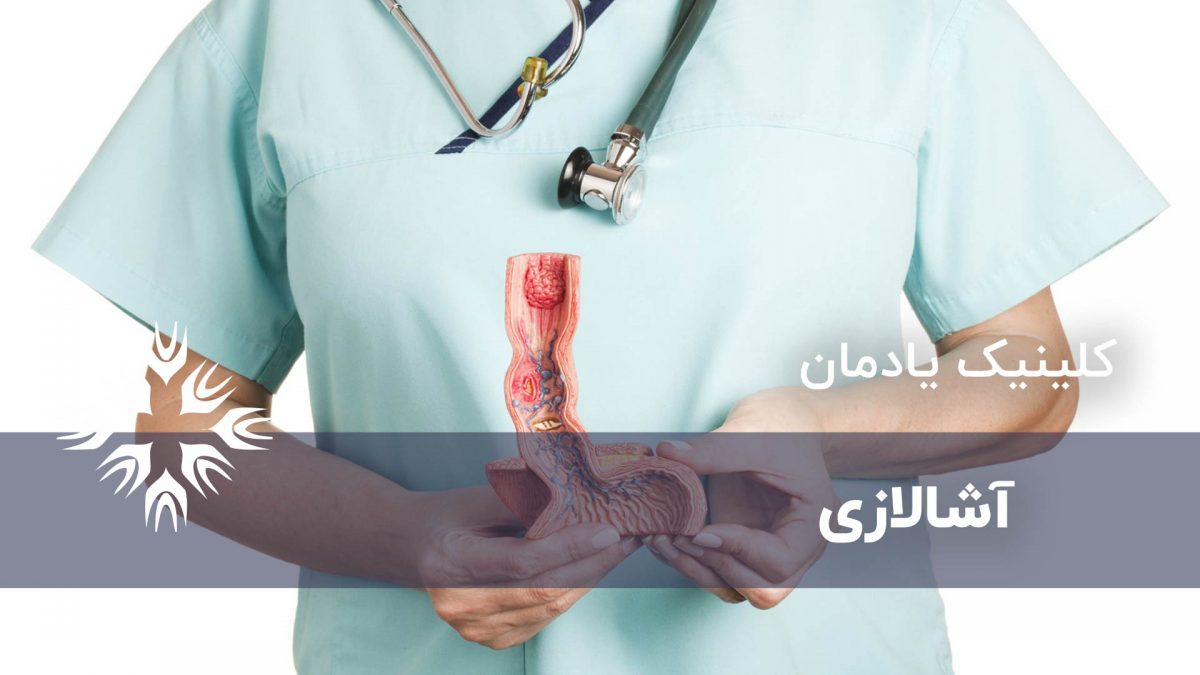 آشالازی چیست