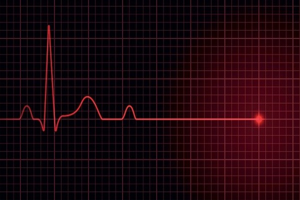 تغییر ضربان قلب