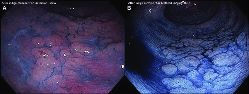 کرومواندوسکوپی