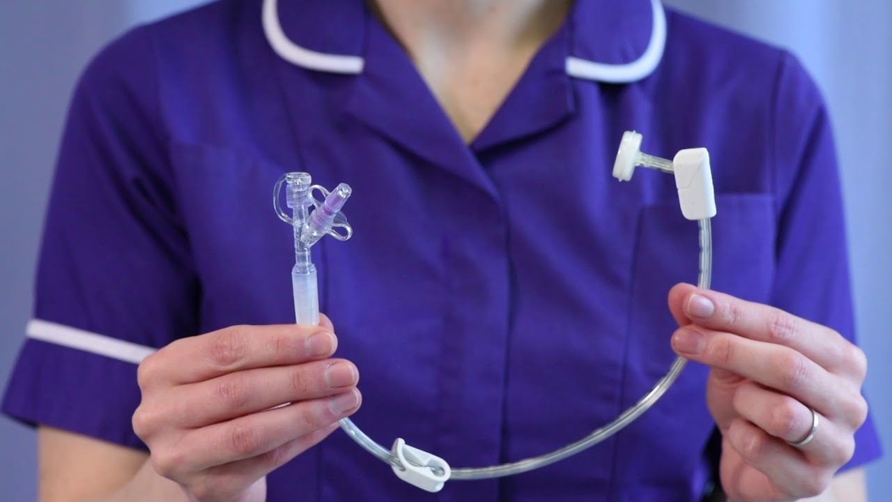 لوله پگ (PEG) برای معده چیست و چه کاربردی دارد؟