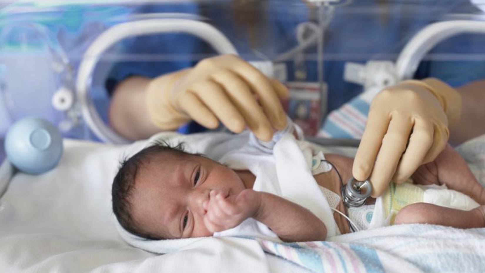 گاستروستومی برای تغذیه نوزادان نارس، Gastrostomy چیست؟