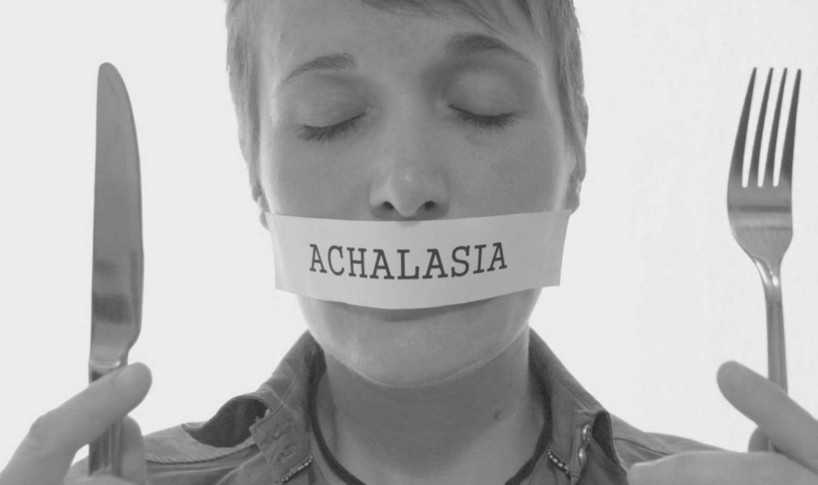 اختلال بلع و آشالازی