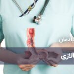 آشالازی چیست