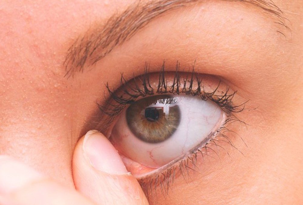 با دلایل قی کردن چشمان آشنا شوید