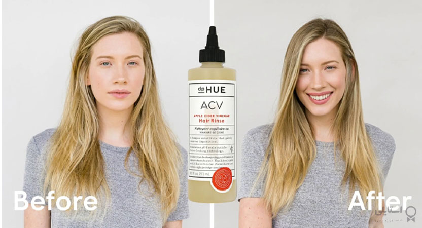 با سرکه سیب سفید سر خود را آبکشی کنید