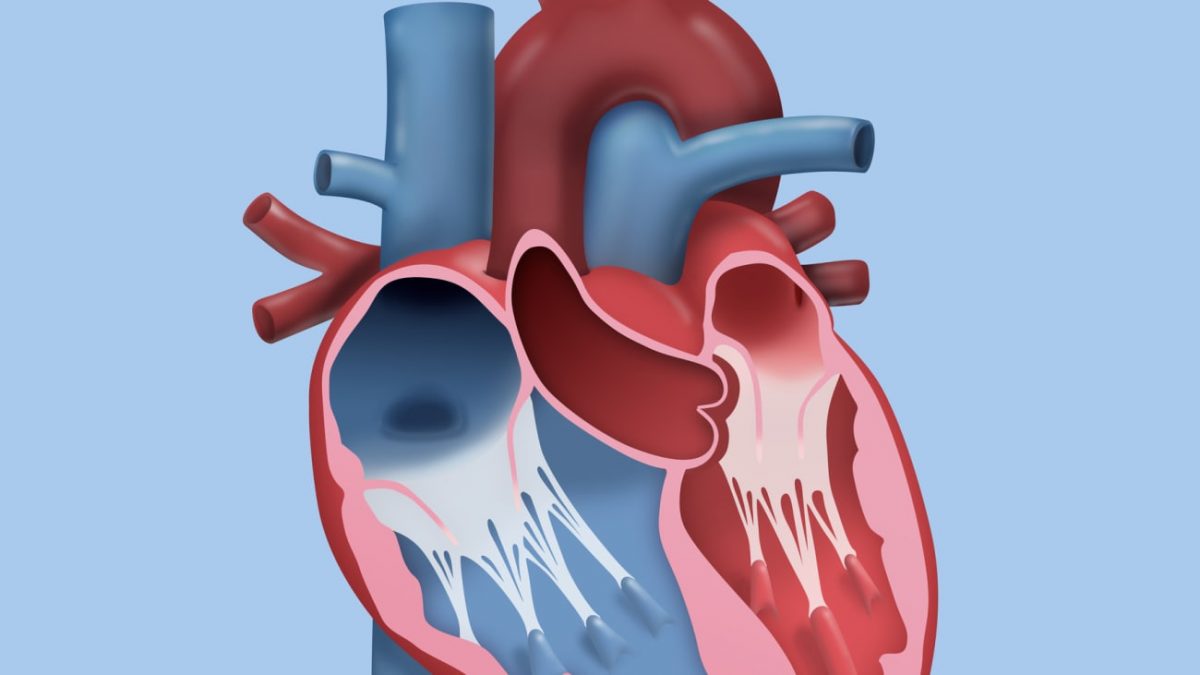 برگشت مجدد دریچه میترال و راههای درمان