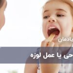 جراحی یا عمل لوزه