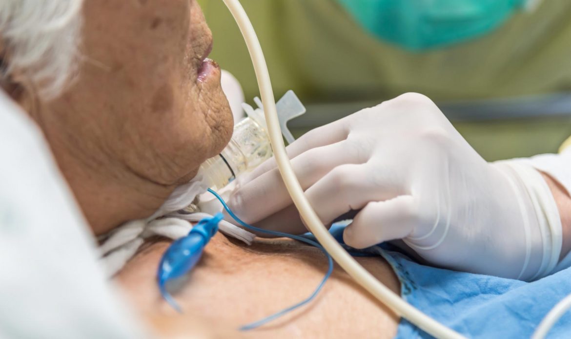 ارزیابی بلع بیماران دارای تراکئوستومی