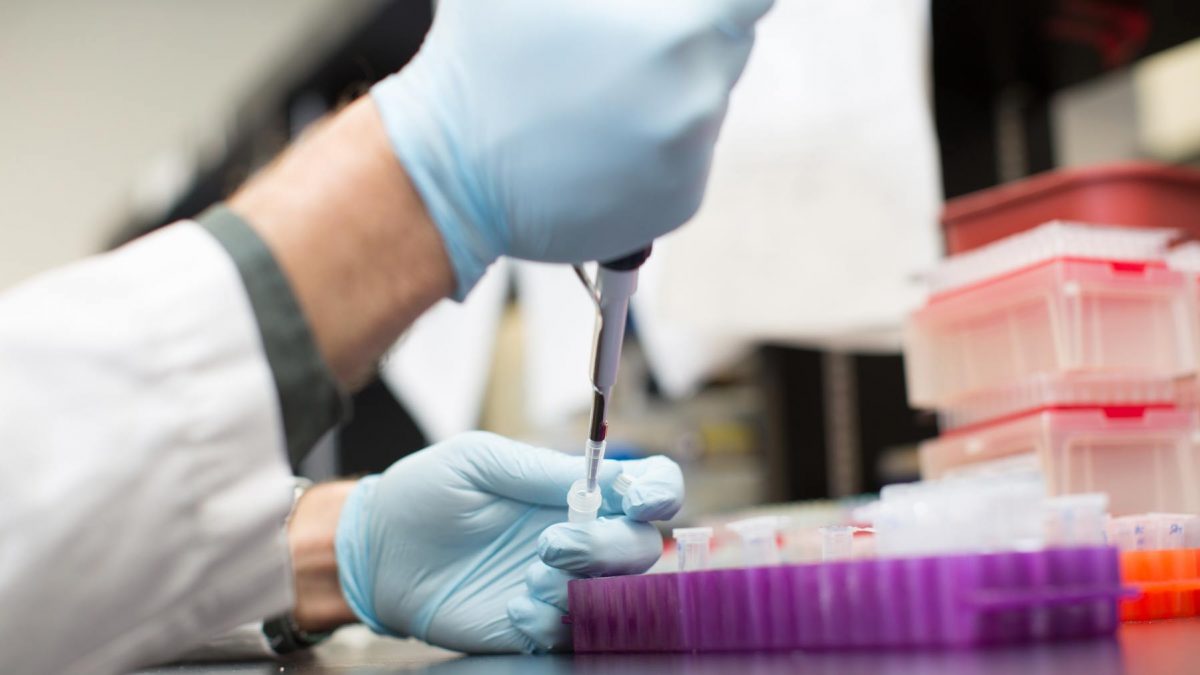 بیماری هانتینگتون و مشکلات عصب