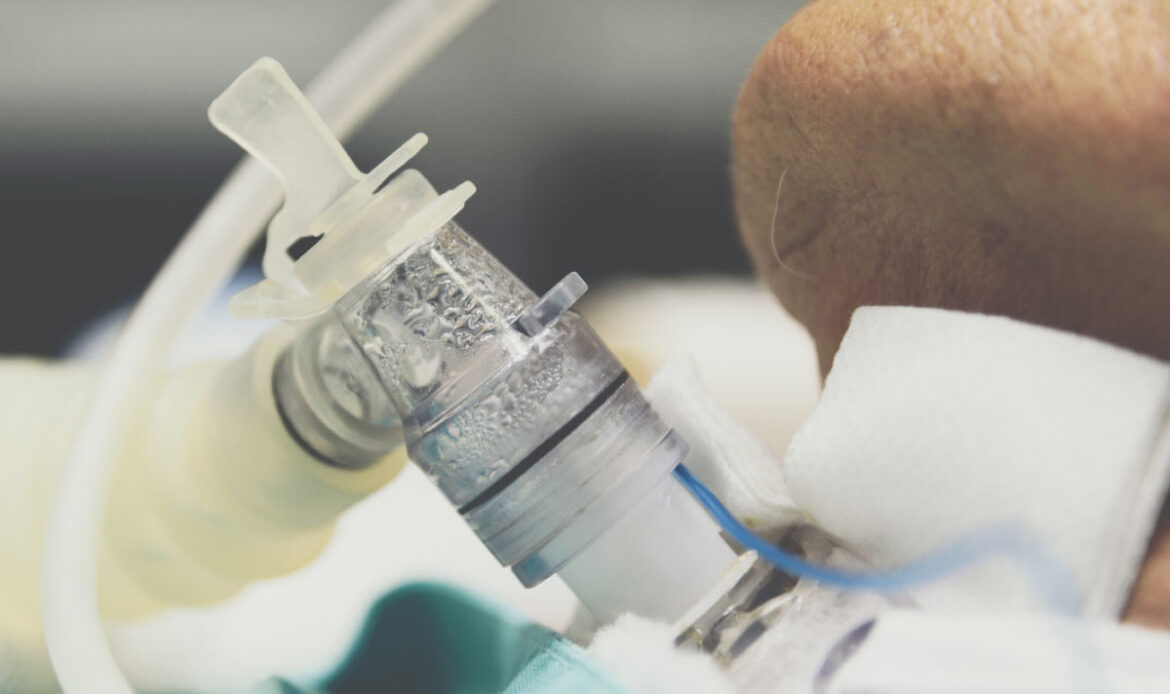 تراکیوستومی