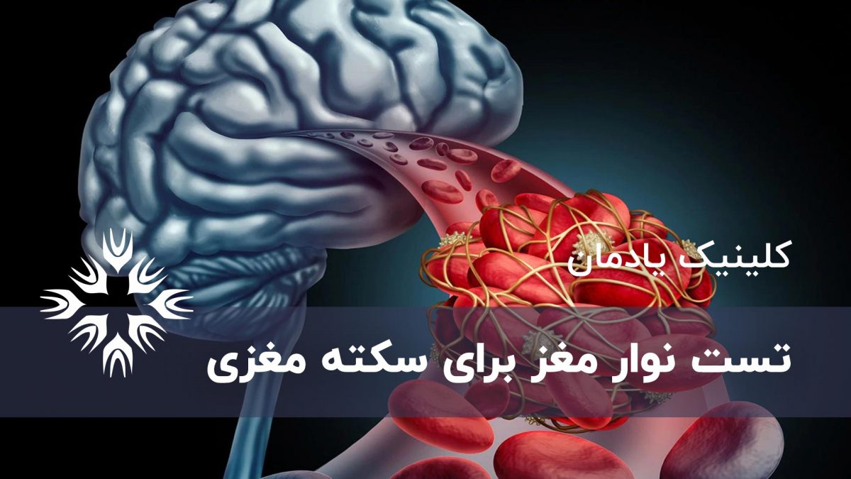 تست نوار مغز برای سکته مغزی