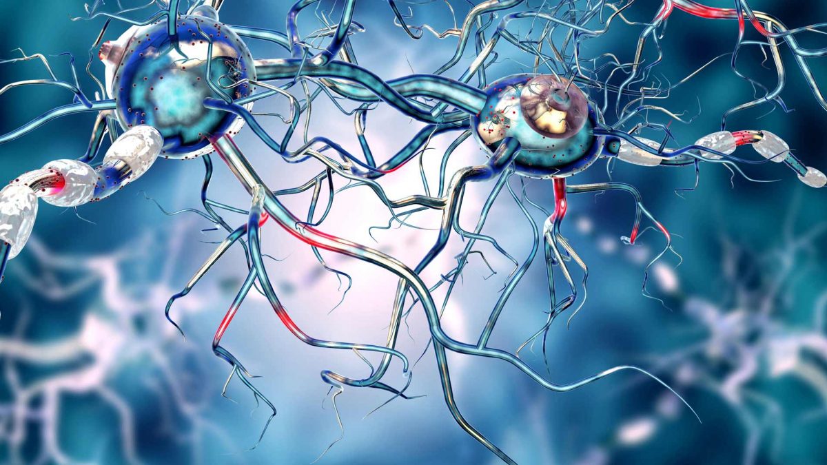 تشخیص و درمان بیماری هانتینگتون
