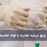 5 سوال رایج درباره تغذیه با لوله تغذیه