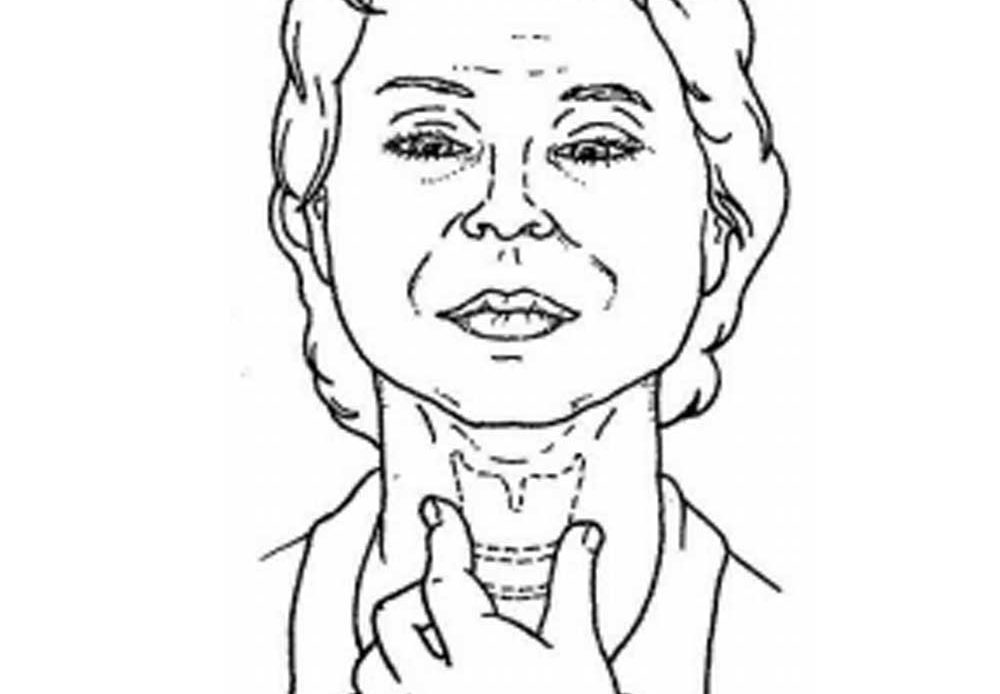 مانور ماندلسون